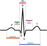 ECG